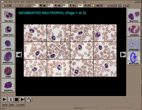 Hematology Screen Shot - Click for Larger Image